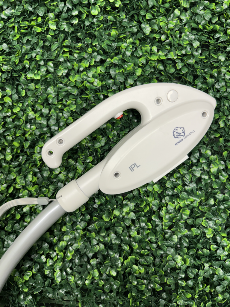 IPL photo facial treatment in Yakima