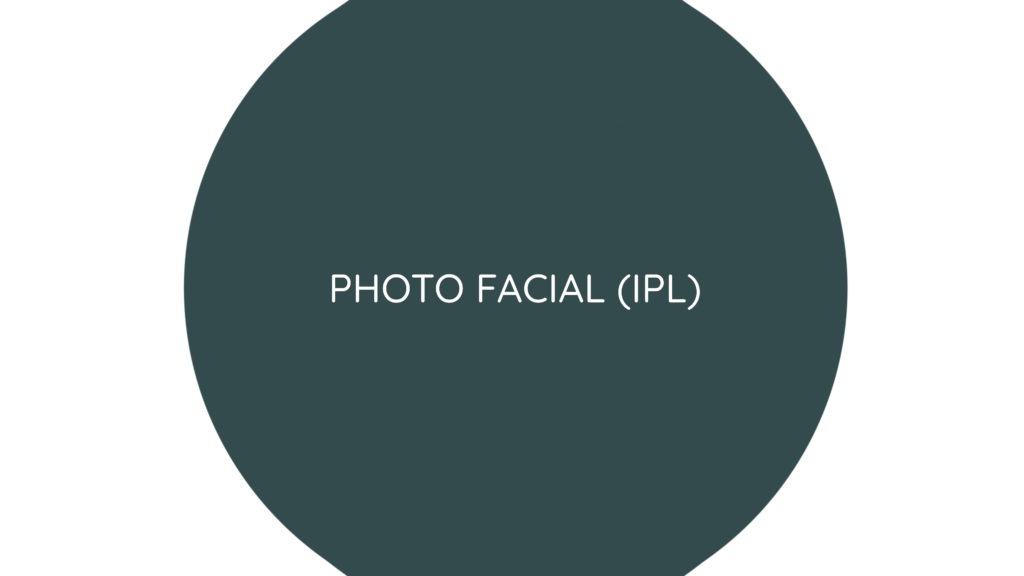 IPL photo facial treatment in Yakima