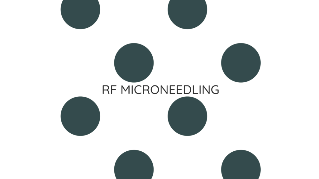 RF microneedling treatment in yakima