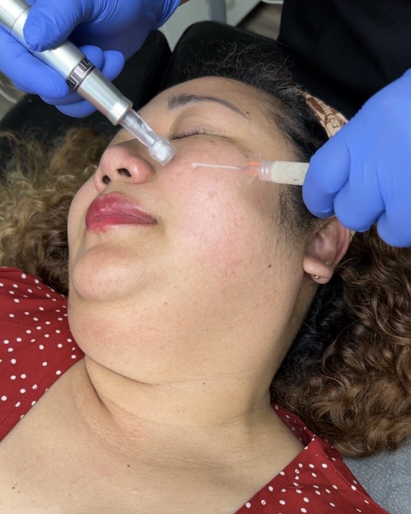 Skin Hydration Treatment in Yakima